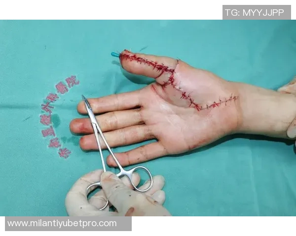 黄威手术时间确定将于10月10日进行恢复计划全力以赴期待重返赛场 黄威手术时间确定将于10月10日进行恢复计划全力以赴期待重返赛场